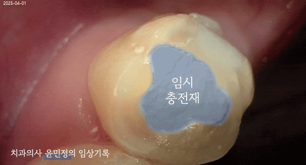 Treatment case image 3