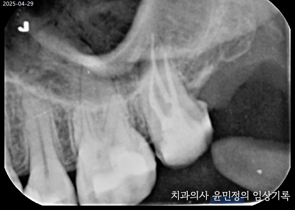 Treatment case image 4