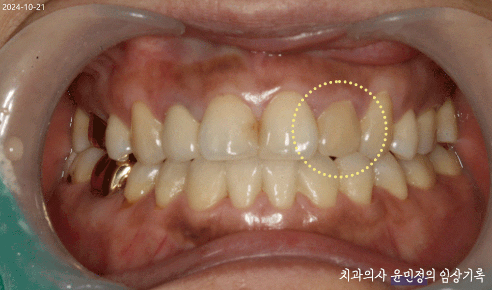 Treatment case image 1