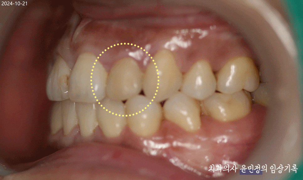 Treatment case image 2