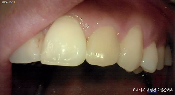 Treatment case image 3