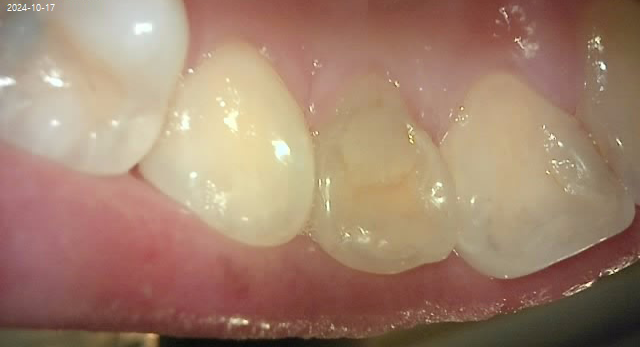 Treatment case image 7