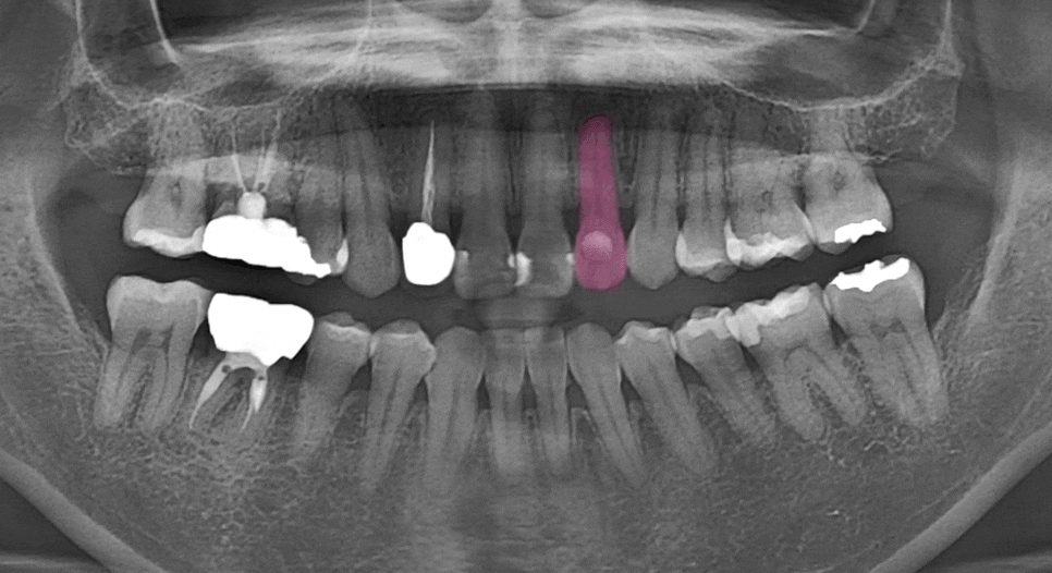 Treatment case image 8