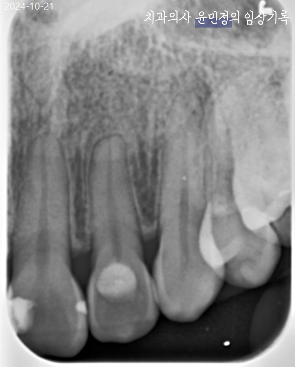 Treatment case image 9
