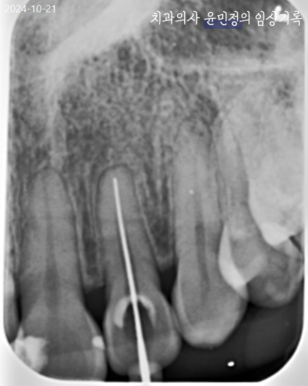 Treatment case image 10