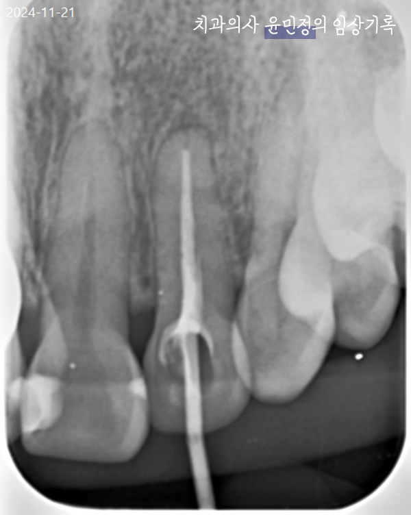 Treatment case image 11