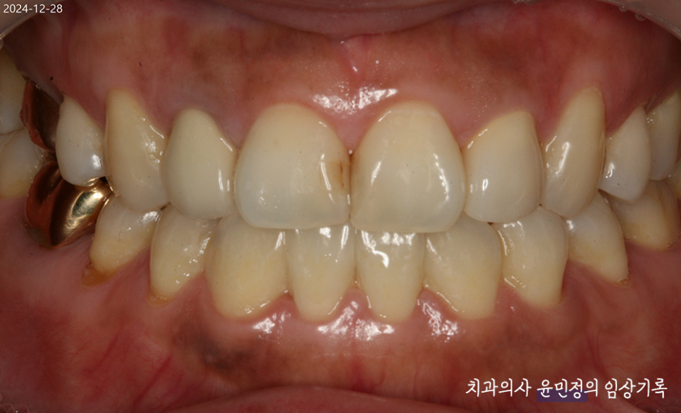 Treatment case image 13