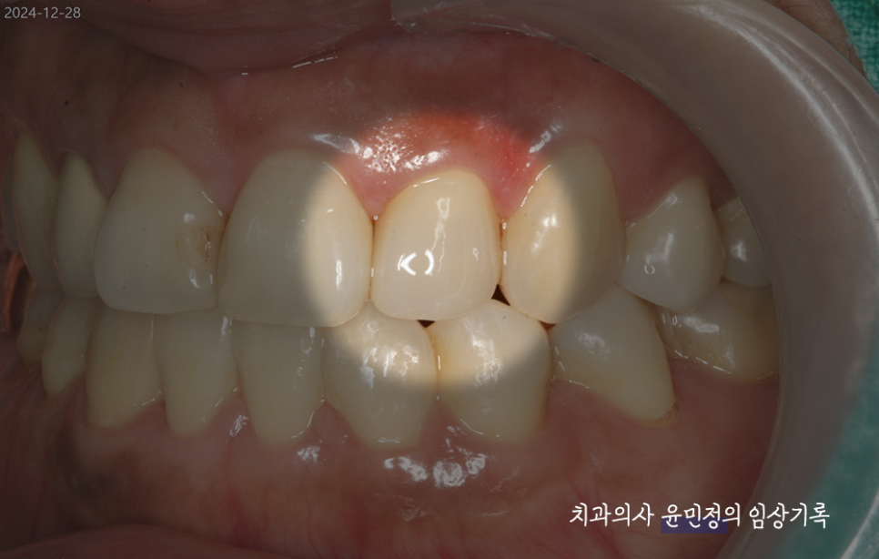 Treatment case image 14
