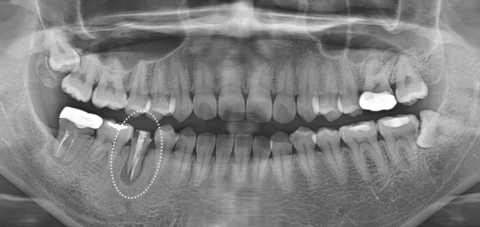 Treatment case image 1