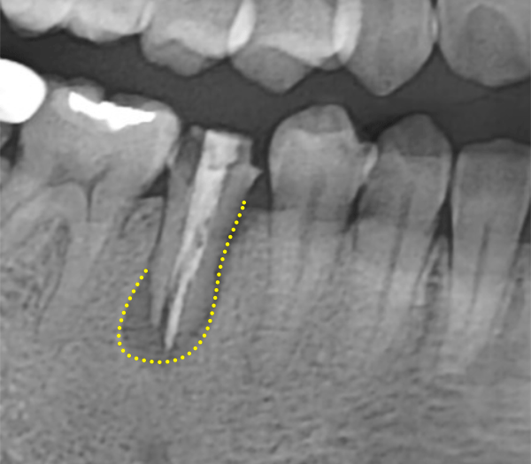 Treatment case image 2
