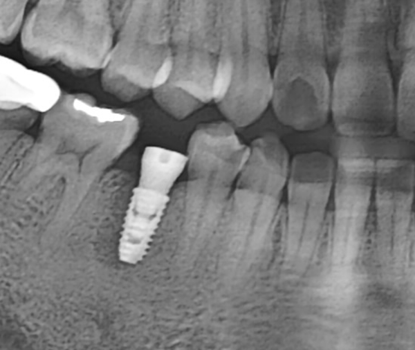 Treatment case image 5