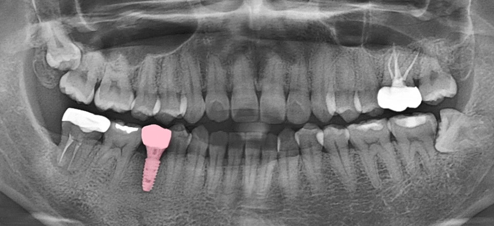 Treatment case image 7
