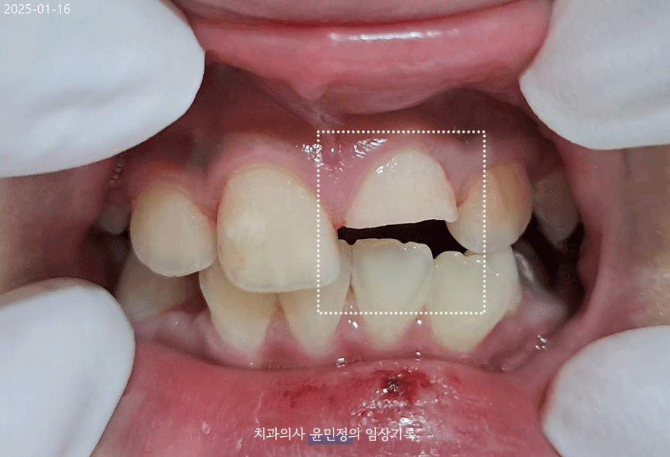 Treatment case image 1