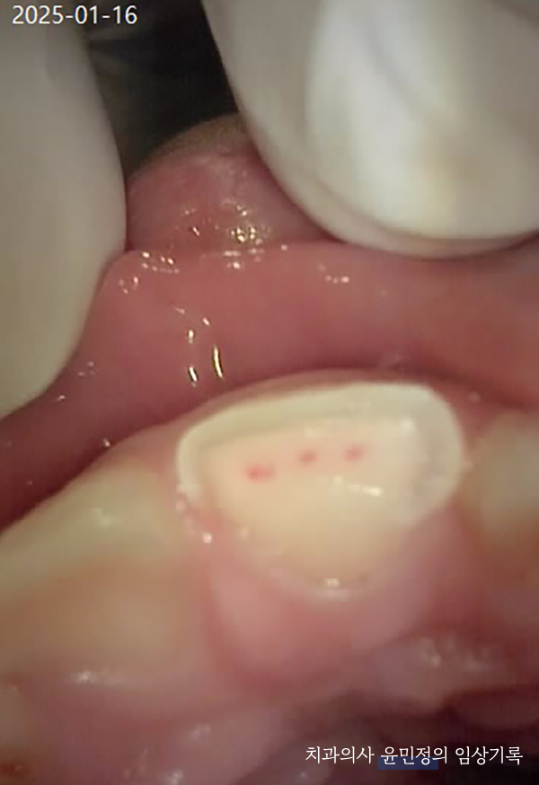 Treatment case image 3