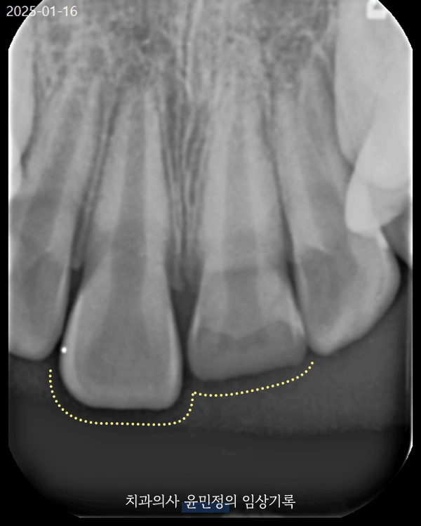 Treatment case image 4