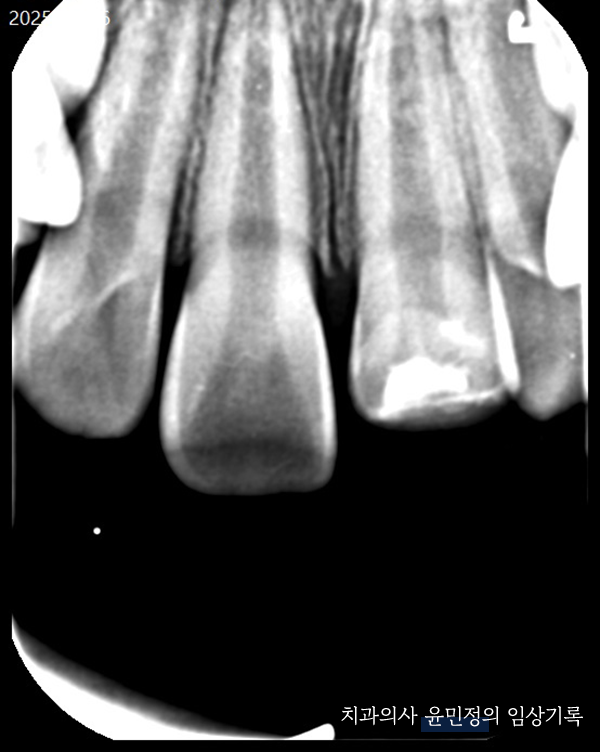 Treatment case image 7
