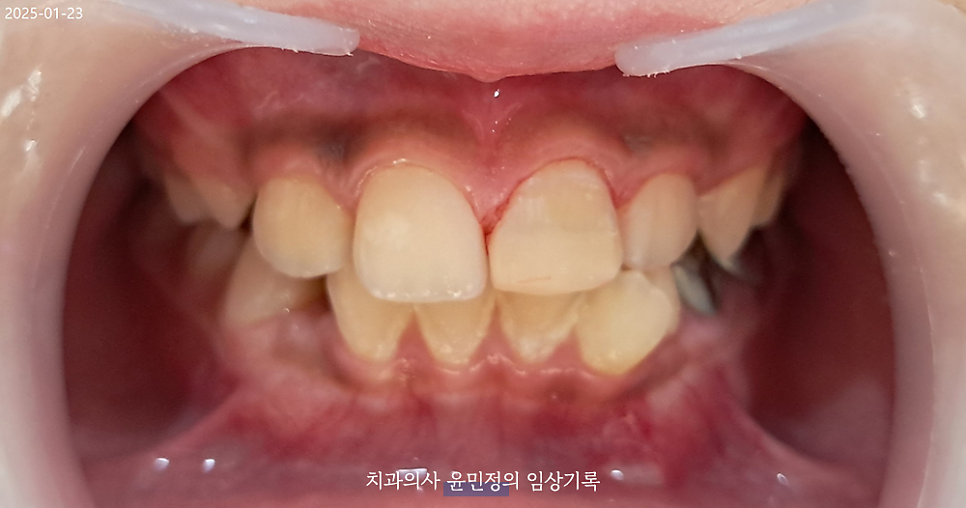 Treatment case image 8