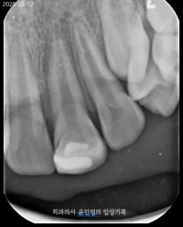 Treatment case image 9