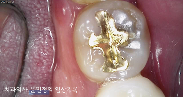 Treatment case image 1