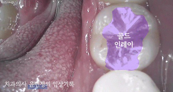 Treatment case image 6