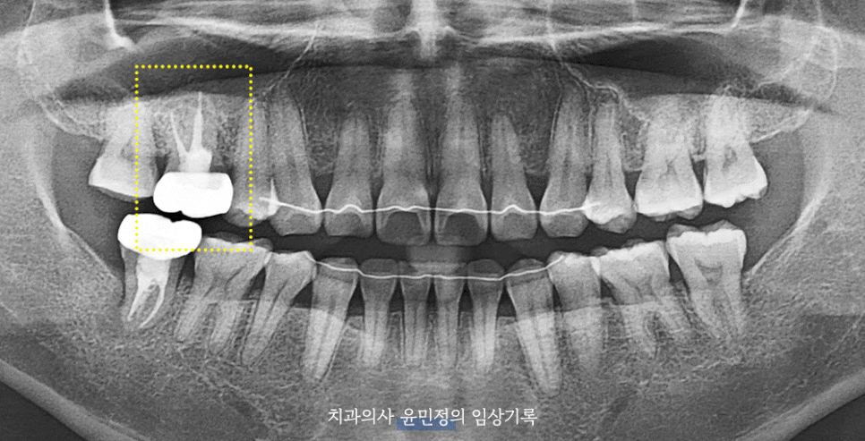 Treatment case image 1