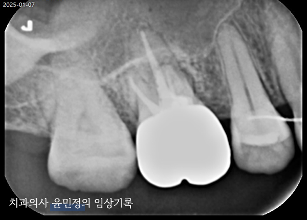 Treatment case image 3