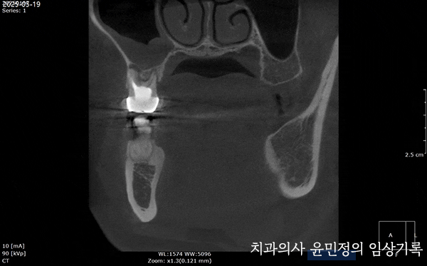 Treatment case image 4