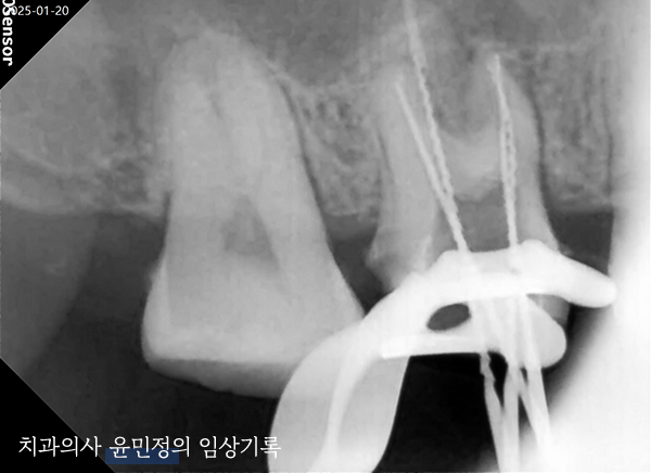 Treatment case image 5