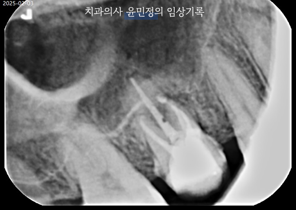 Treatment case image 6