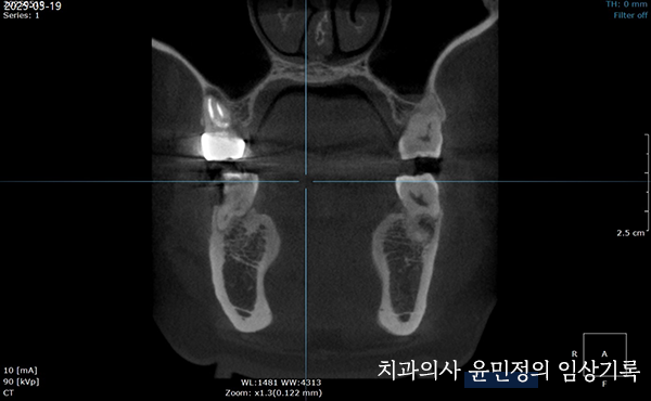 Treatment case image 7