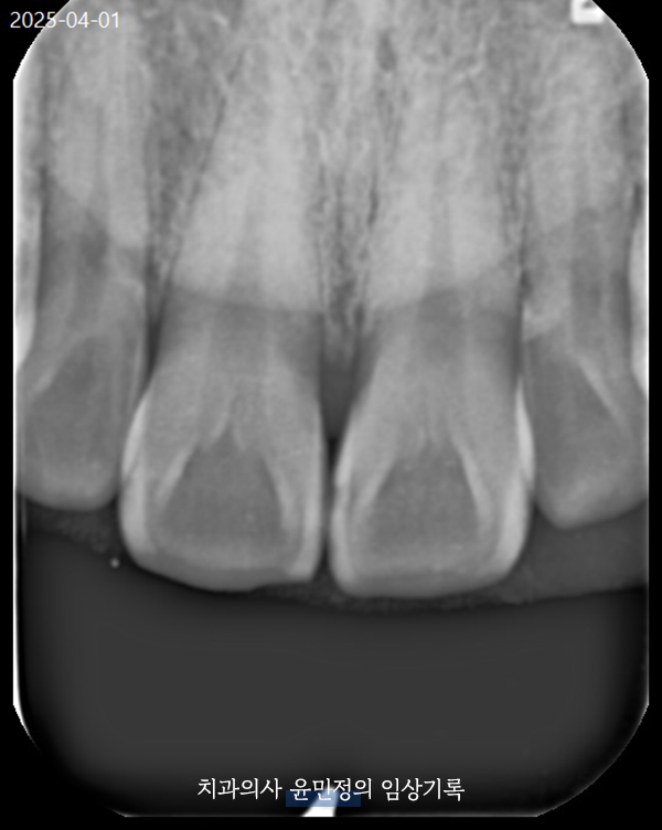Treatment case image 3