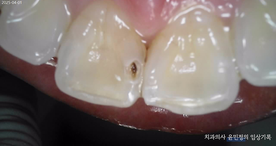 Treatment case image 4