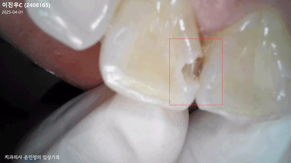 Treatment case image 8