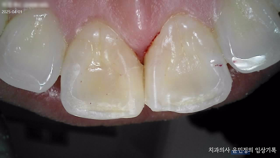 Treatment case image 10