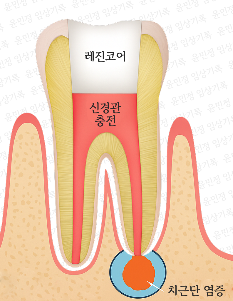 Treatment case image 1
