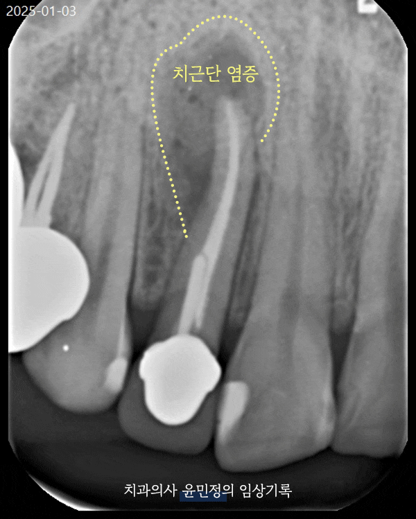 Treatment case image 2