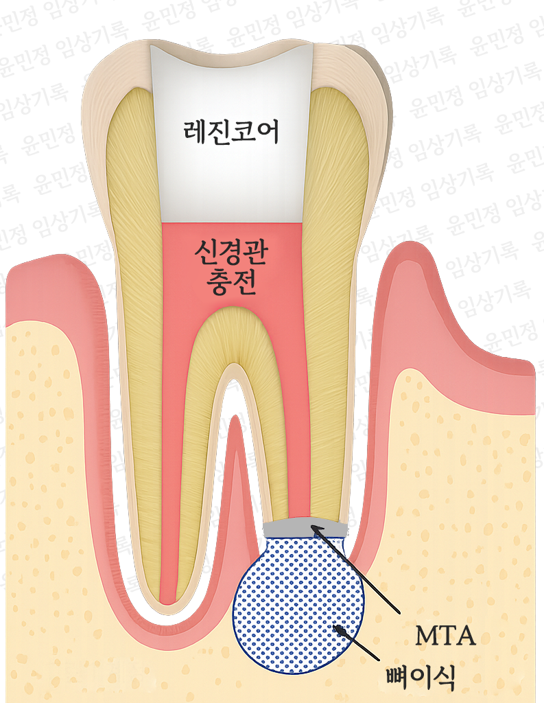 Treatment case image 3