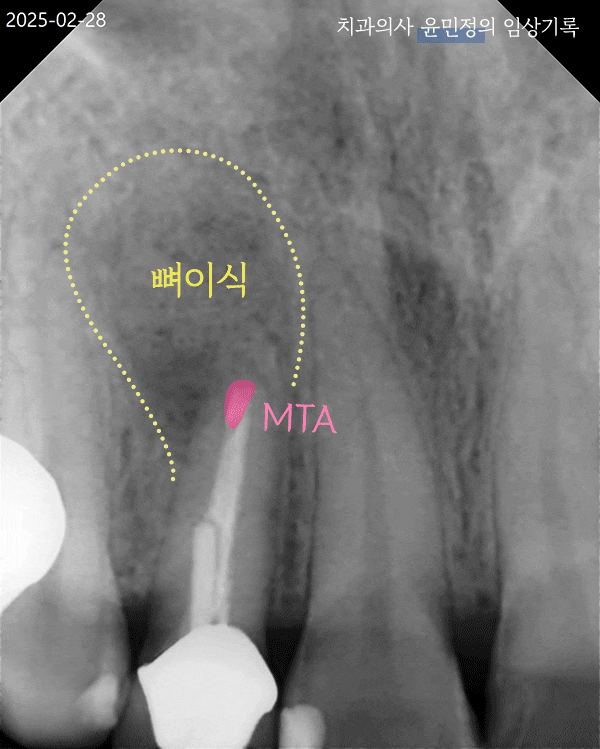 Treatment case image 3