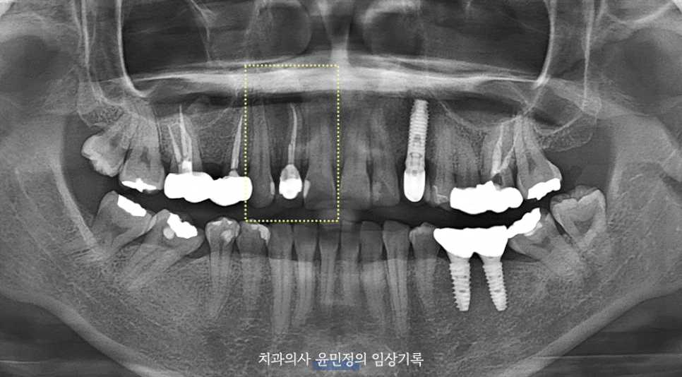Treatment case image 1
