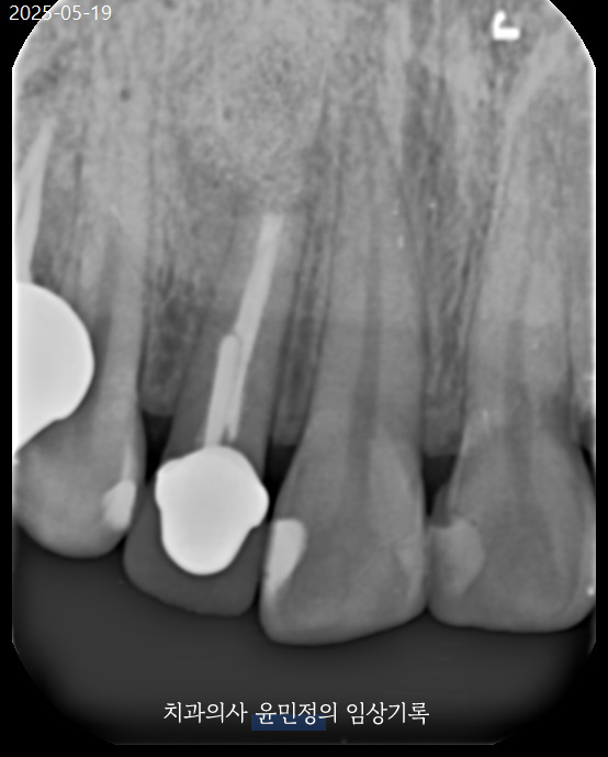 Treatment case image 4