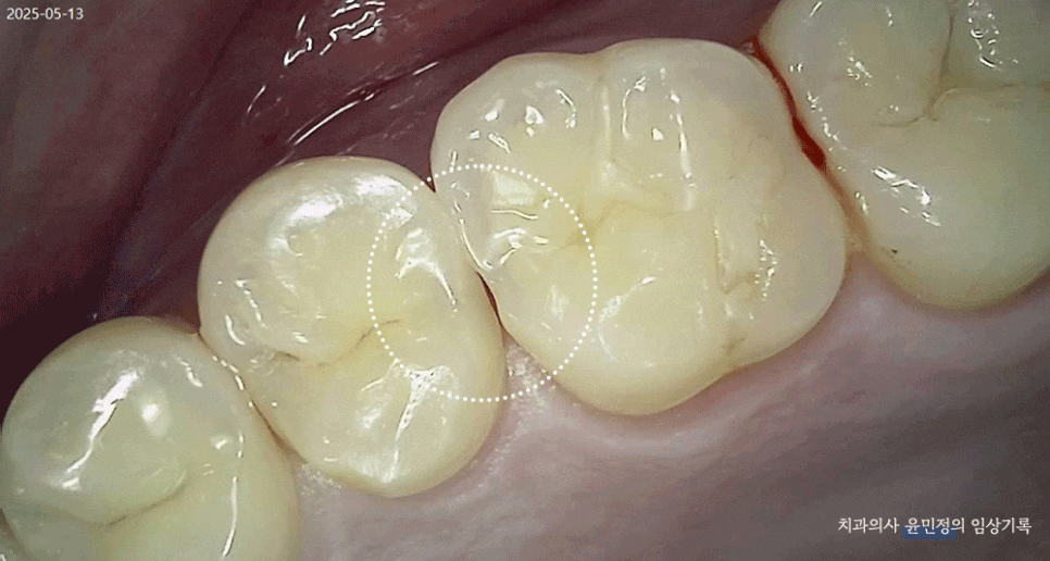 Treatment case image 1