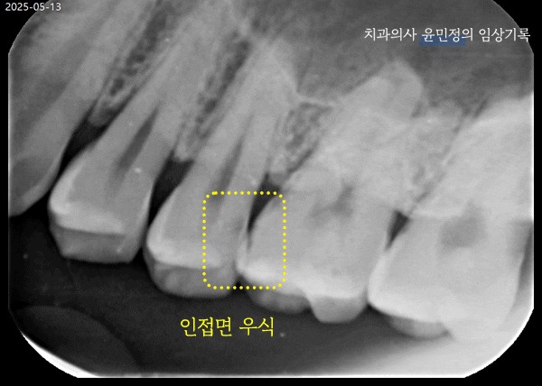 Treatment case image 2