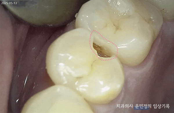 Treatment case image 4