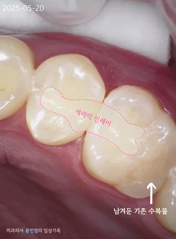 Treatment case image 10