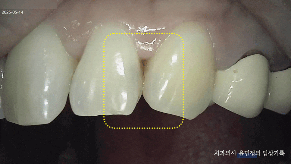 Treatment case image 1