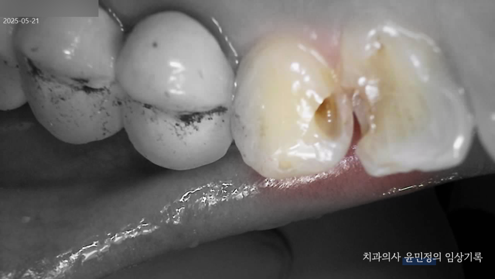Treatment case image 3