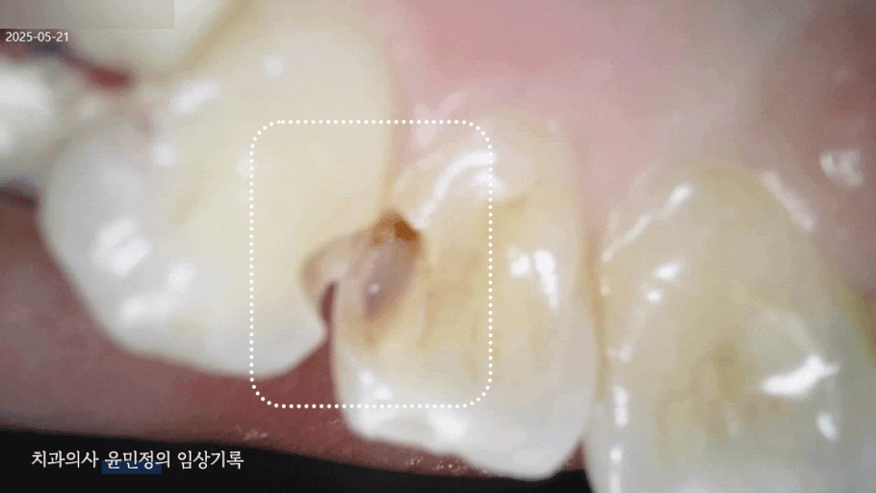 Treatment case image 4