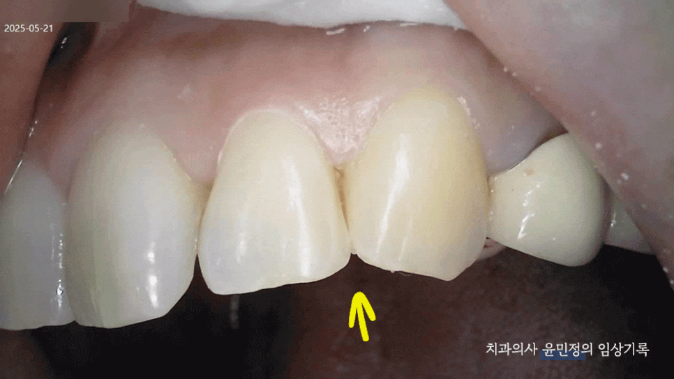 Treatment case image 5