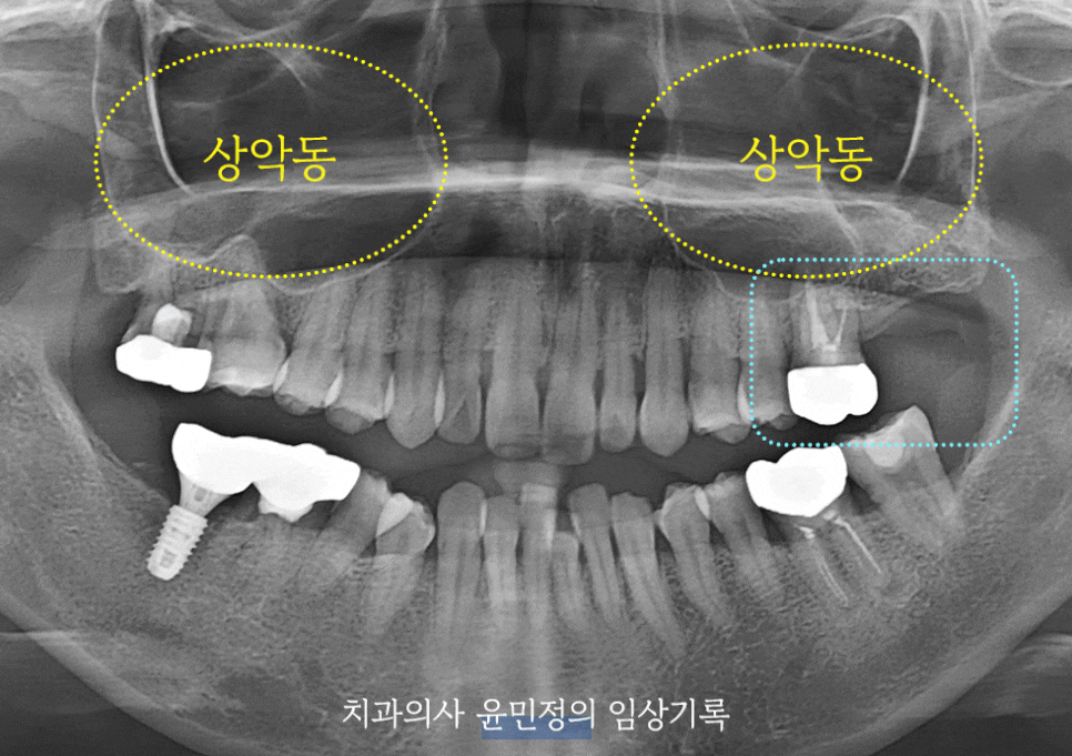 Treatment case image 1