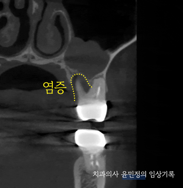 Treatment case image 2